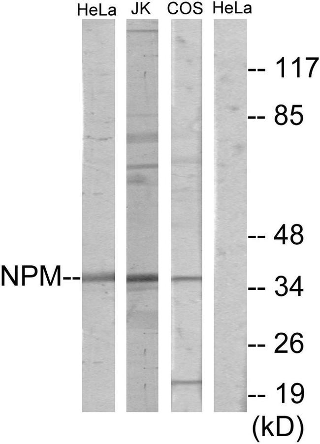 NPM1 Antibody in Western Blot (WB)