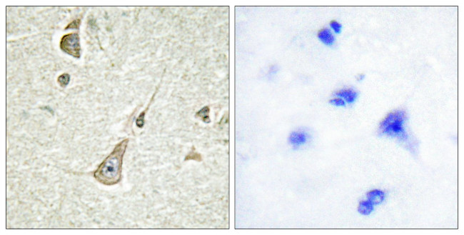 PCDH11Y Antibody in Immunohistochemistry (Paraffin) (IHC (P))