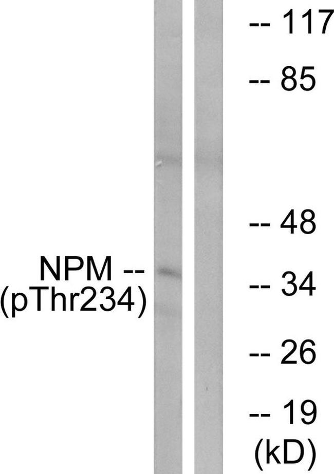 Phospho-NPM1 (Thr234) Antibody in Western Blot (WB)