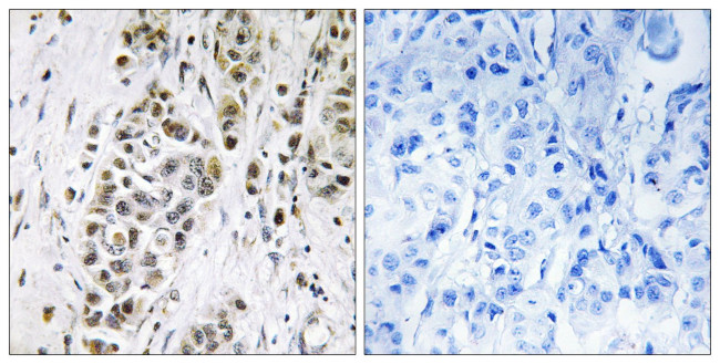 XRN2 Antibody in Immunohistochemistry (Paraffin) (IHC (P))