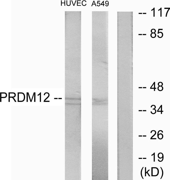 PRDM12 Antibody in Western Blot (WB)