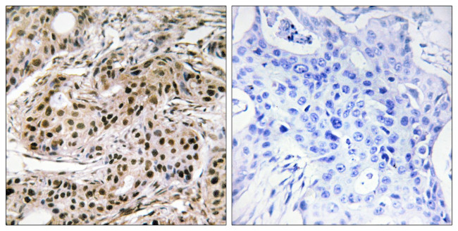 Phospho-PDCD4 (Ser457) Antibody in Immunohistochemistry (Paraffin) (IHC (P))