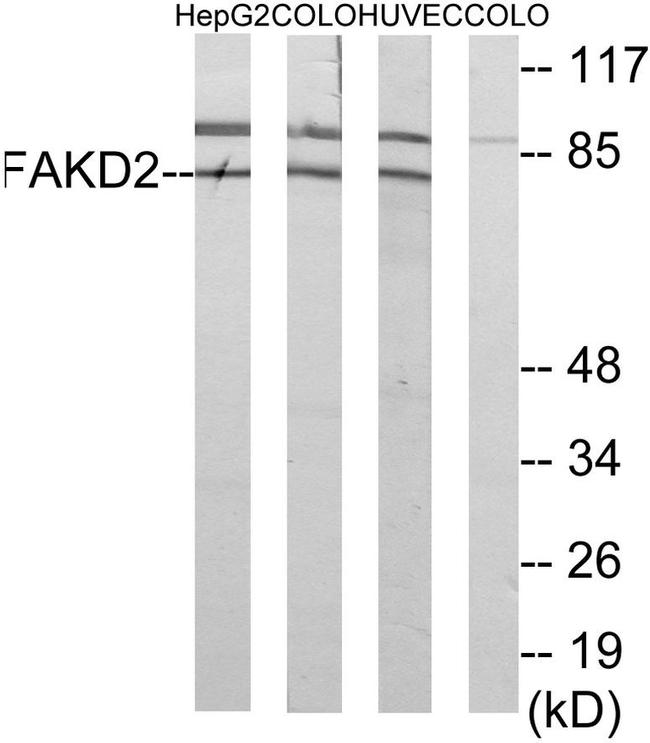 FASTKD2 Antibody in Western Blot (WB)