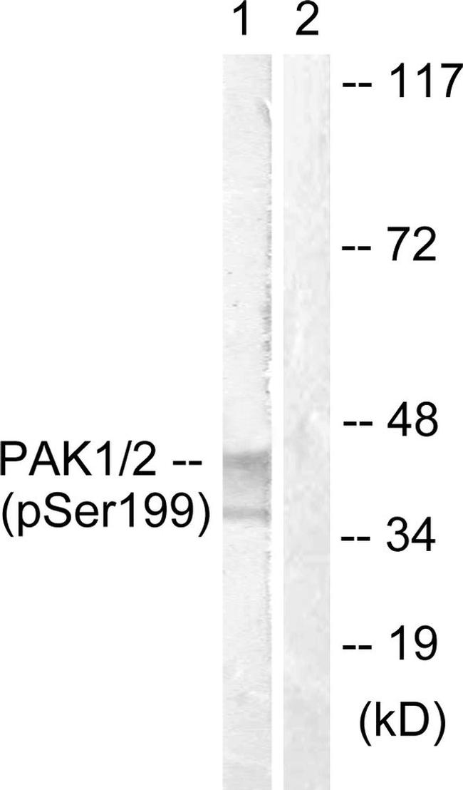 Phospho-TERT (Ser824) Antibody in Western Blot (WB)