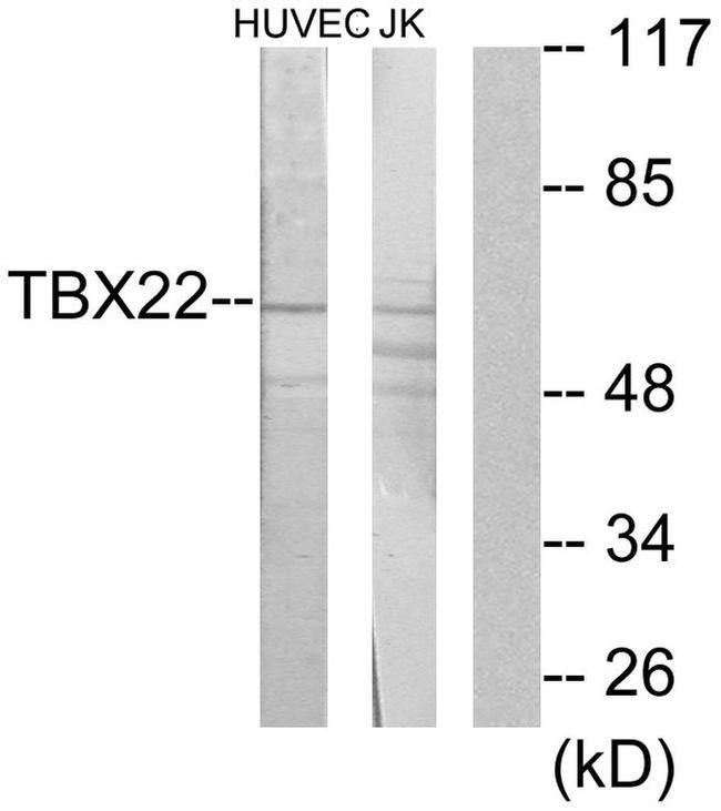 TBX22 Antibody in Western Blot (WB)