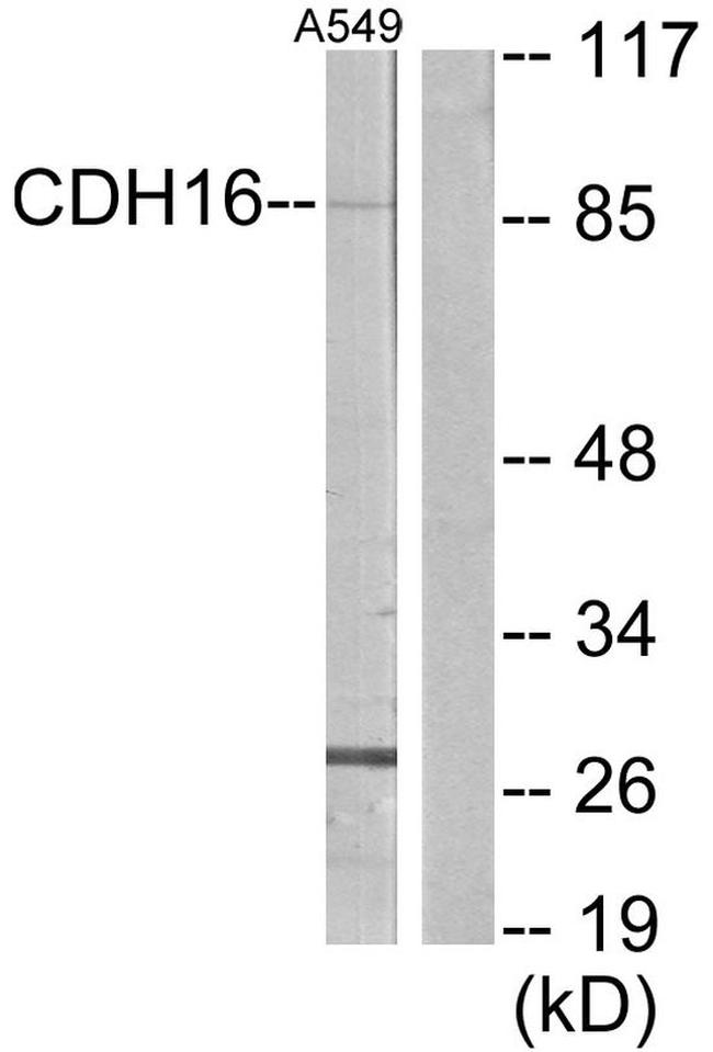 CDH16 Antibody in Western Blot (WB)