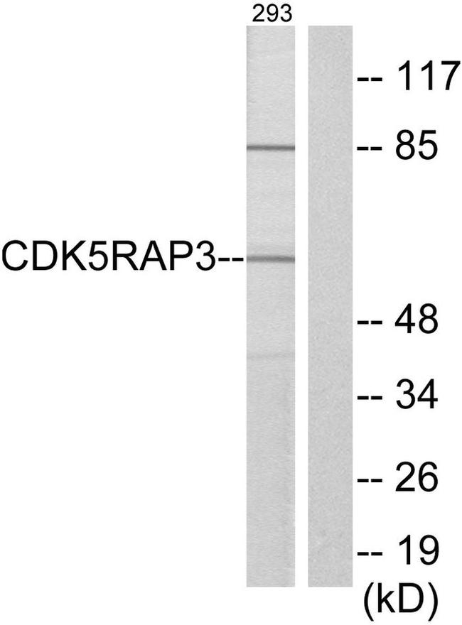 CDK5RAP3 Antibody in Western Blot (WB)