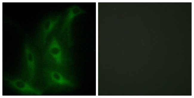 COL4A6 Antibody in Immunocytochemistry (ICC/IF)