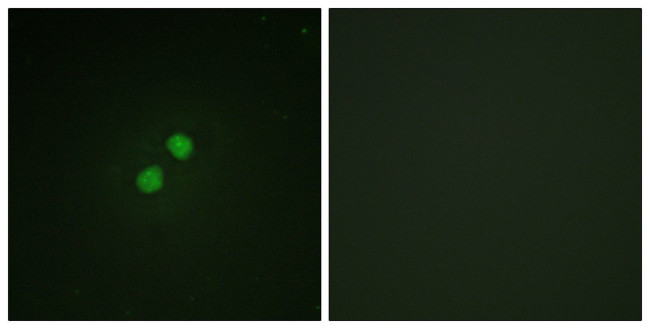 Phospho-NBS1 (Ser278) Antibody in Immunocytochemistry (ICC/IF)