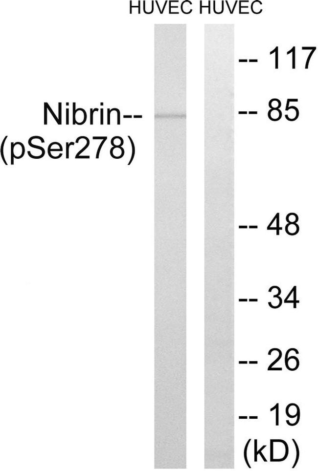 Phospho-NBS1 (Ser278) Antibody in Western Blot (WB)