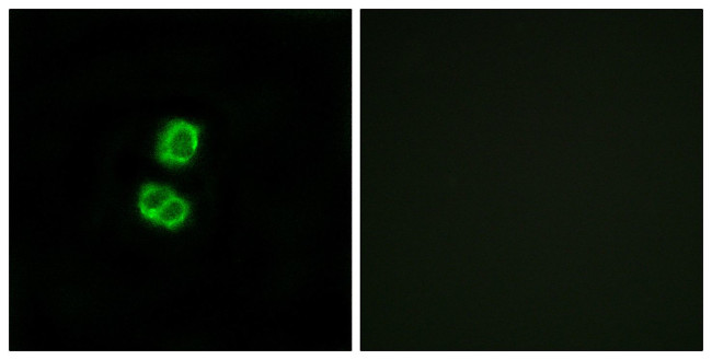 FGF22 Antibody in Immunocytochemistry (ICC/IF)