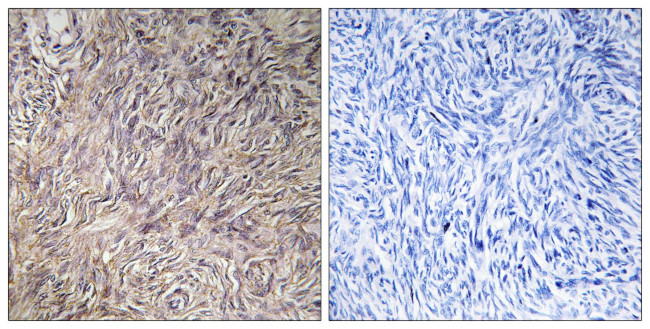 FGF22 Antibody in Immunohistochemistry (Paraffin) (IHC (P))