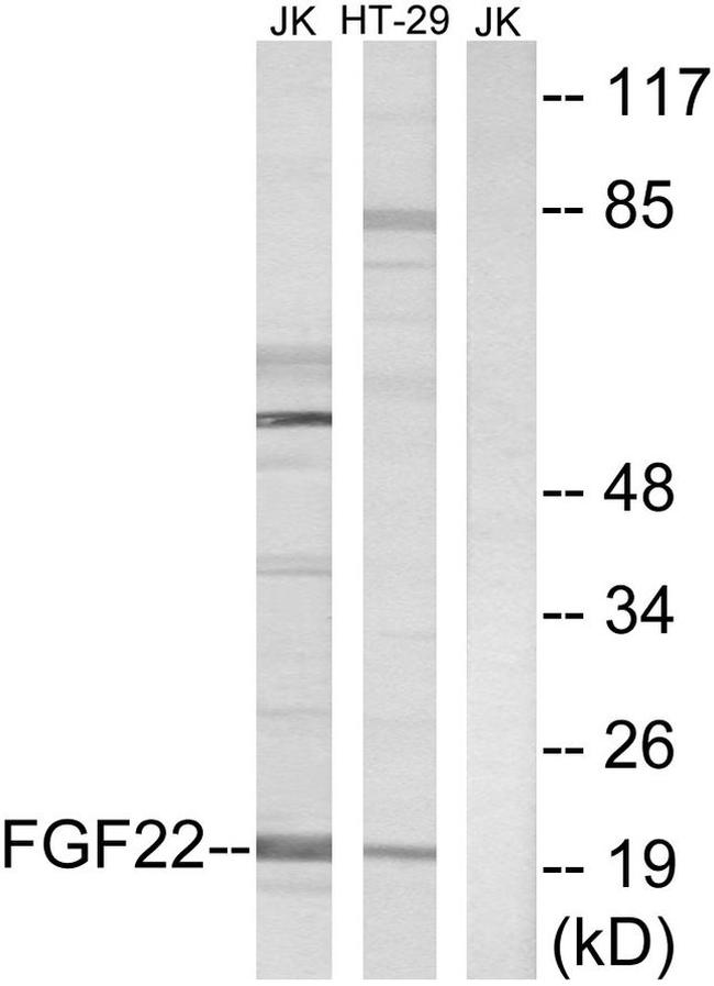 FGF22 Antibody in Western Blot (WB)