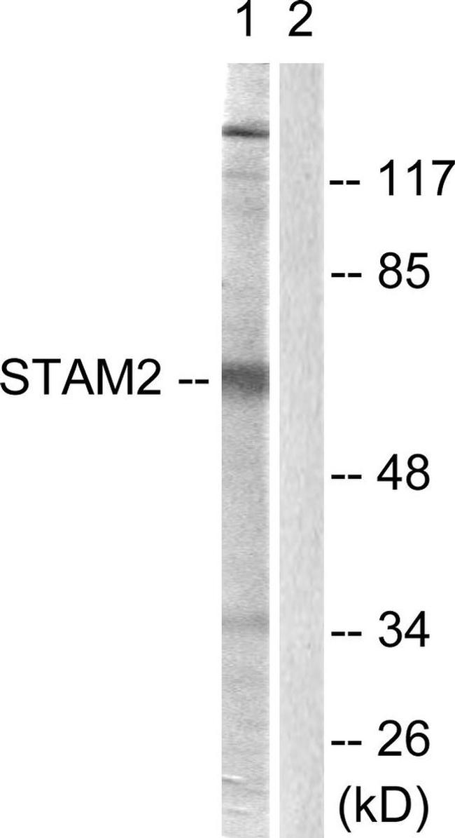 STAM2 Antibody in Western Blot (WB)