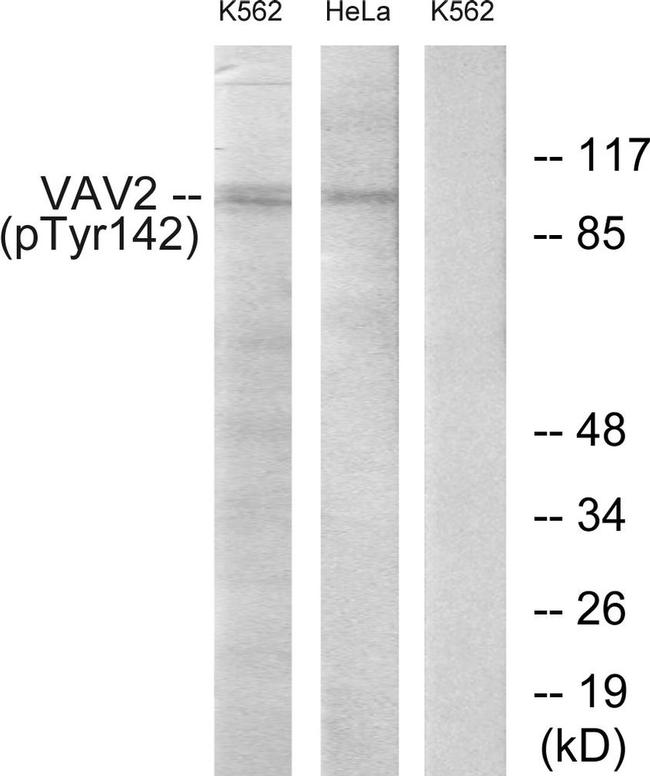 Phospho-VAV2 (Tyr142) Antibody in Western Blot (WB)