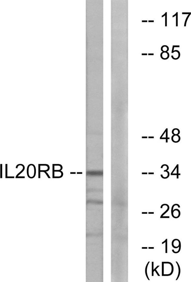 IL20RB Antibody in Western Blot (WB)