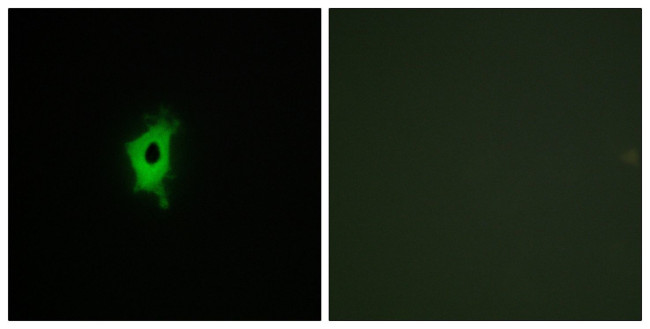 Galectin 2 Antibody in Immunocytochemistry (ICC/IF)