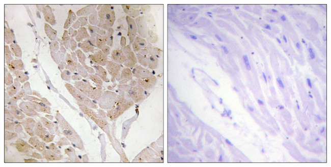 Galectin 2 Antibody in Immunohistochemistry (Paraffin) (IHC (P))