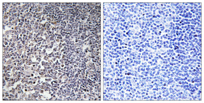 MRPS16 Antibody in Immunohistochemistry (Paraffin) (IHC (P))