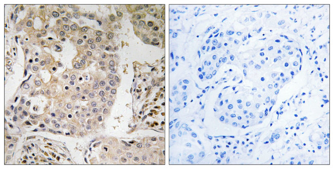 MRPL41 Antibody in Immunohistochemistry (Paraffin) (IHC (P))