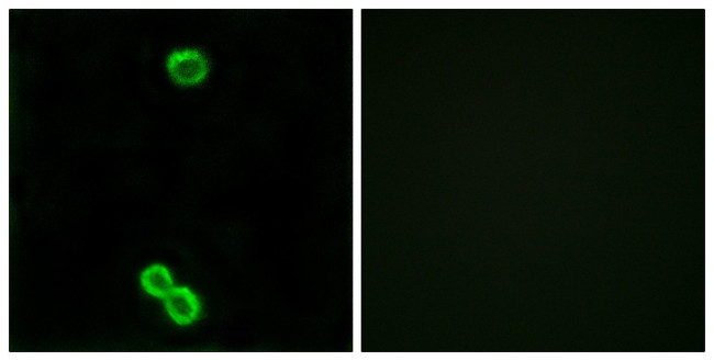 RPL3L Antibody in Immunocytochemistry (ICC/IF)