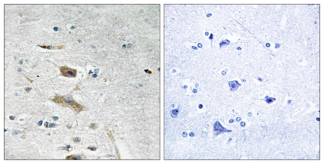 ABHD4 Antibody in Immunohistochemistry (Paraffin) (IHC (P))