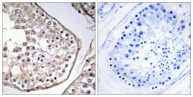 BAGE3 Antibody in Immunohistochemistry (Paraffin) (IHC (P))