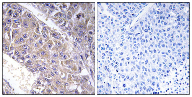 B4GALT3 Antibody in Immunohistochemistry (Paraffin) (IHC (P))