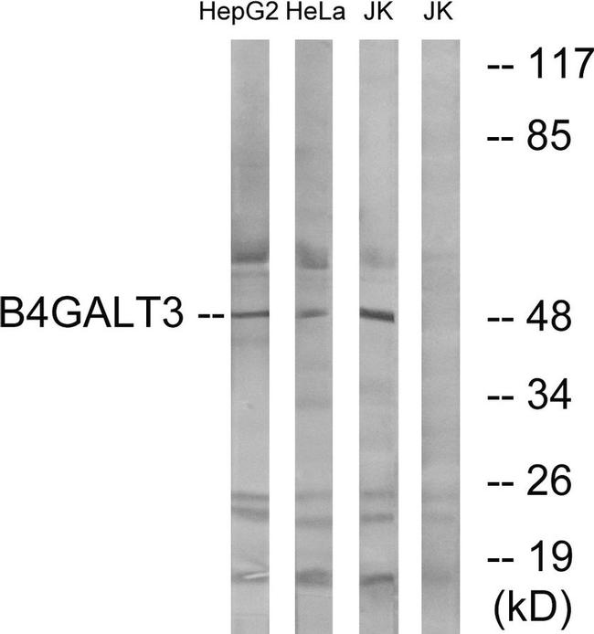 B4GALT3 Antibody in Western Blot (WB)