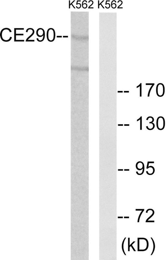 CEP290 Antibody in Western Blot (WB)