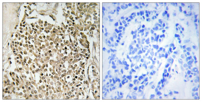 CEP350 Antibody in Immunohistochemistry (Paraffin) (IHC (P))