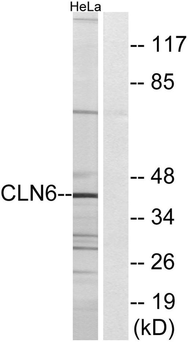 CLN6 Antibody in Western Blot (WB)