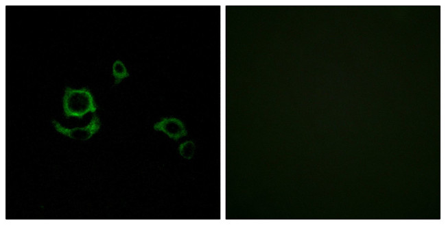 Factor XIII B Antibody in Immunocytochemistry (ICC/IF)