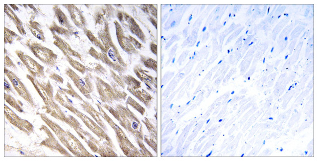 Factor XIII B Antibody in Immunohistochemistry (Paraffin) (IHC (P))