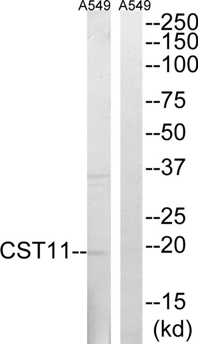 CST11 Antibody in Western Blot (WB)