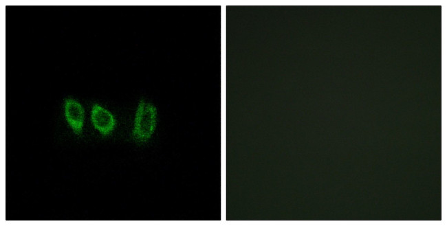 CSTL1 Antibody in Immunocytochemistry (ICC/IF)