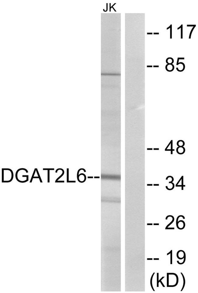 DGAT2L6 Antibody in Western Blot (WB)