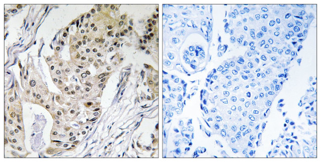 POLE4 Antibody in Immunohistochemistry (Paraffin) (IHC (P))