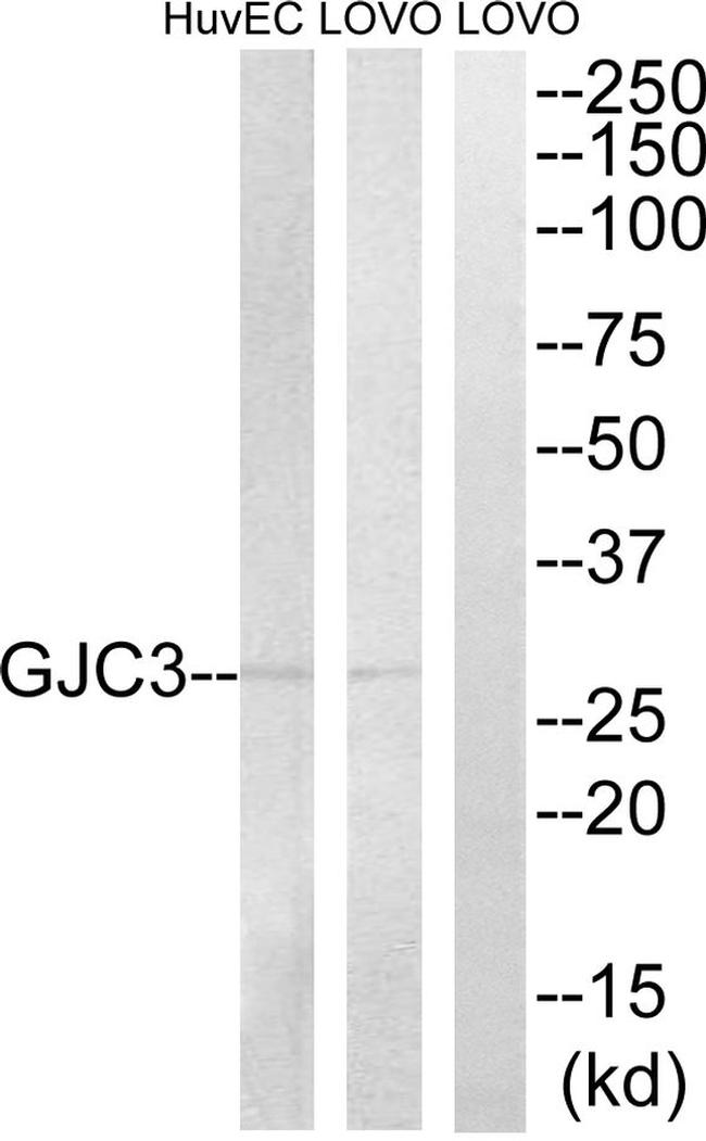 Connexin 29 Antibody in Western Blot (WB)