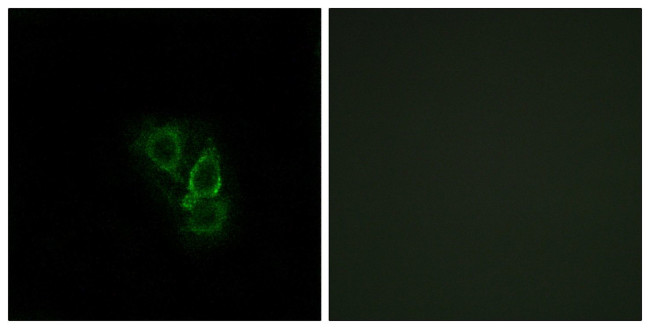 RRAD Antibody in Immunocytochemistry (ICC/IF)