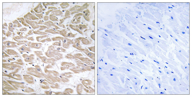 RRAD Antibody in Immunohistochemistry (Paraffin) (IHC (P))