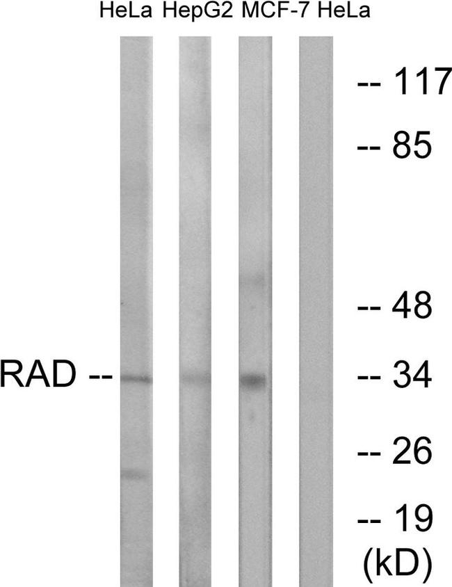 RRAD Antibody in Western Blot (WB)