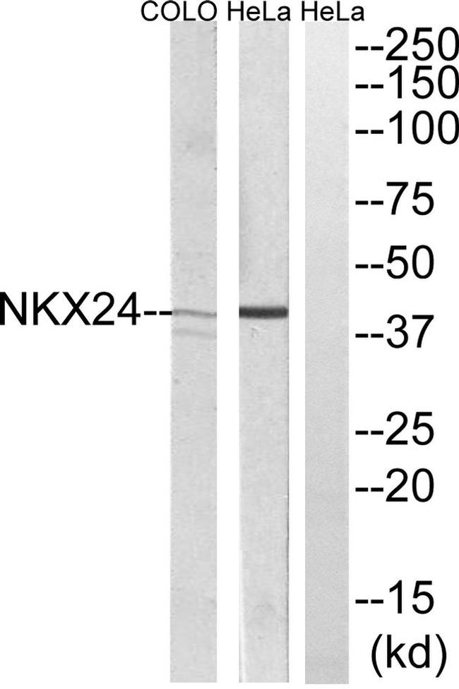 Nkx2.4 Antibody in Western Blot (WB)