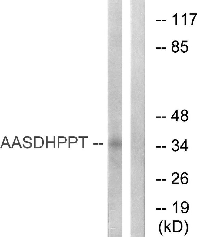 AASDHPPT Antibody in Western Blot (WB)