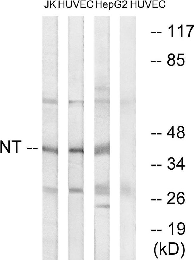 NTM Antibody in Western Blot (WB)