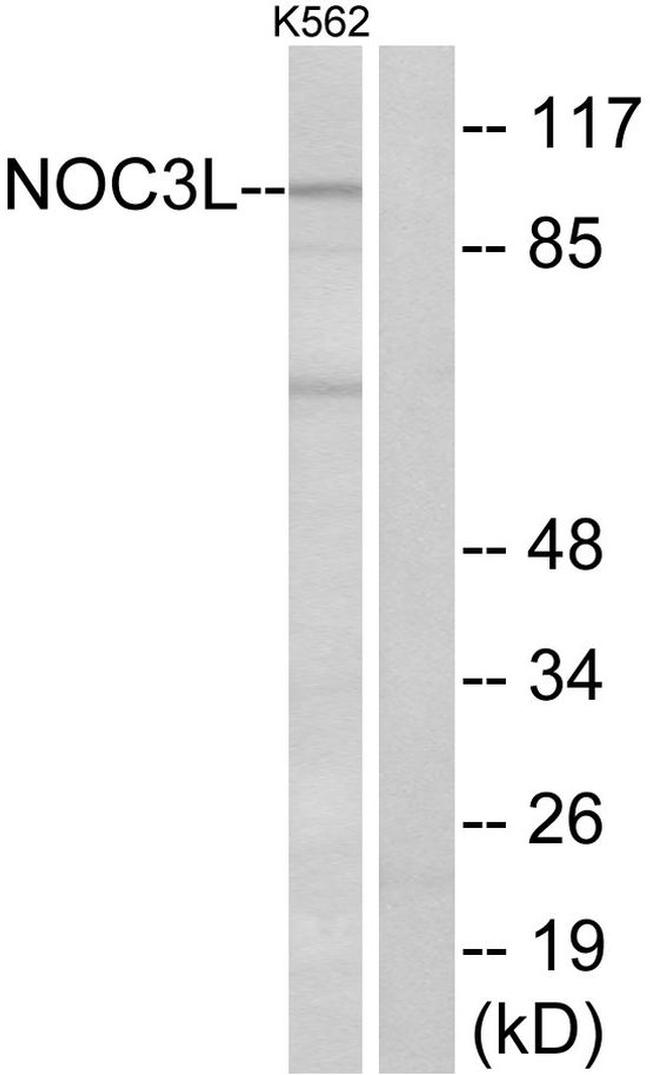 NOC3L Antibody in Western Blot (WB)