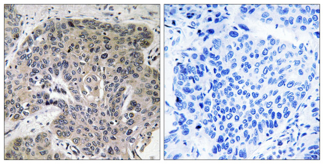 S100A3 Antibody in Immunohistochemistry (Paraffin) (IHC (P))