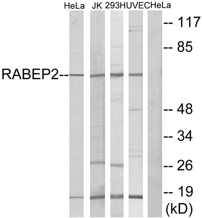 RABEP2 Antibody in Western Blot (WB)