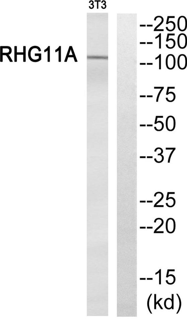 ARHGAP11A Antibody in Western Blot (WB)