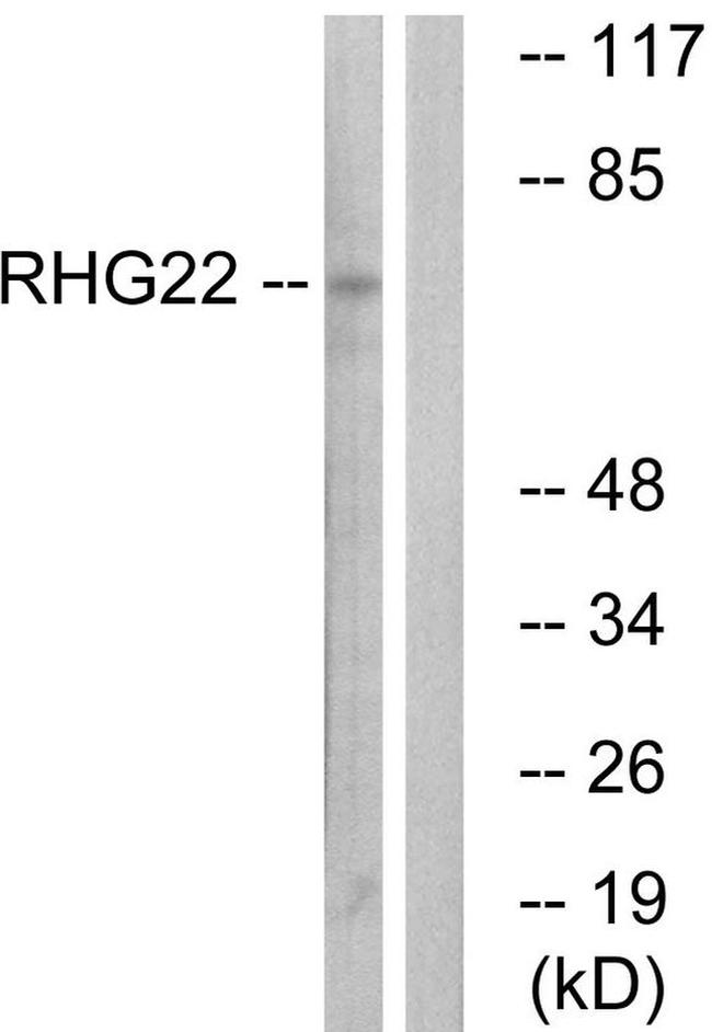 ARHGAP22 Antibody in Western Blot (WB)